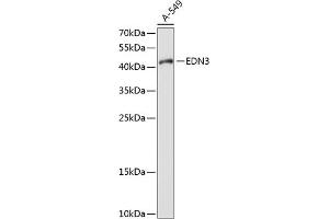 Western blot analysis of extracts of A-549 cells, using EDN3 antibody (ABIN6127870, ABIN6139934, ABIN6139936 and ABIN6214707) at 1:1000 dilution. (Endothelin 3 anticorps  (AA 17-187))