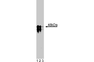 Western Blotting (WB) image for anti-Inhibitor of kappa Light Polypeptide Gene Enhancer in B-Cells, Kinase gamma (IKBKG) (AA 278-396) antibody (ABIN968464)