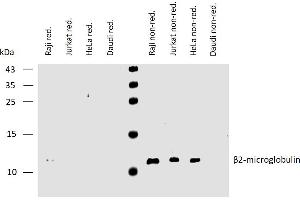 Western Blotting analysis (non-reducing conditions) of whole cell lysate of various cell lines using anti-human β2-microglobulin (B2M-01).