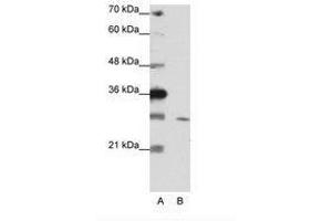 Image no. 2 for anti-Zinc Finger Protein 397 (ZNF397) (C-Term) antibody (ABIN202144) (ZNF397 anticorps  (C-Term))