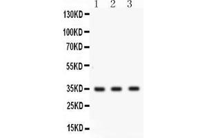 Western blot analysis of Cathepsin G expression in COLO320 whole cell lysates ( Lane 1), MCF-7 whole cell lysates ( Lane 2) and U20S whole cell lysates ( Lane 3). (Cathepsin G anticorps  (AA 25-252))