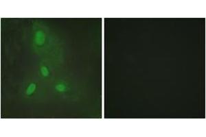 Immunofluorescence analysis of HeLa cells, using BACH1 Antibody. (BACH1 anticorps  (AA 131-180))