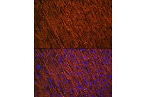 Immunohistochemistry of paraffin-embedded human colon using Desmin Rabbit mAb (ABIN1678733, ABIN3018020, ABIN3018021 and ABIN7101569) at dilution of 1:100 (40x lens). (Desmin anticorps)