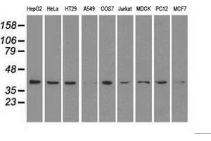 Western blot analysis of extracts (35 µg) from 9 different cell lines by using anti-MAPK1 monoclonal antibody. (ERK2 anticorps)