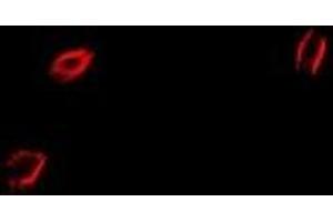 Immunofluorescent analysis of CapZ alpha-2 staining in HepG2 cells.