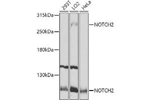 Western blot analysis of extracts of various cell lines, using NOTCH2 antibody (ABIN6132419, ABIN6144736, ABIN6144737 and ABIN6213887) at 1:1000 dilution. (NOTCH2 anticorps  (AA 2242-2471))