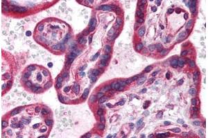 Human Placenta (formalin-fixed, paraffin-embedded) stained with HIF3A antibody ABIN214599 at 5 ug/ml followed by biotinylated goat anti-rabbit IgG secondary antibody ABIN481713, alkaline phosphatase-streptavidin and chromogen.
