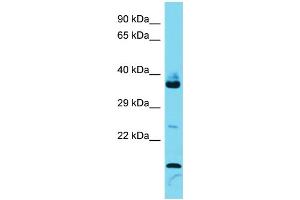 Host: Rabbit  Target Name: Fam133b  Sample Tissue: Mouse Thymus lysates  Antibody Dilution: 1. (FAM133B anticorps  (Middle Region))