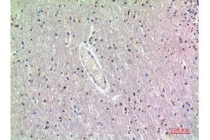 Immunohistochemistry (IHC) analysis of paraffin-embedded Human Brain, antibody was diluted at 1:200.