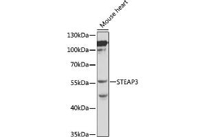 Western blot analysis of extracts of mouse heart, using STE antibody (ABIN3021067, ABIN3021068, ABIN3021069 and ABIN6213936) at 1:1000 dilution. (STEAP3 anticorps  (AA 1-180))