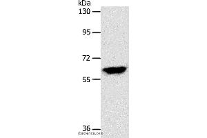 Western blot analysis of Mouse brain tissue, using INA Polyclonal Antibody at dilution of 1:500 (INA anticorps)