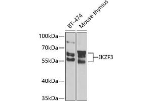 Western blot analysis of extracts of various cell lines, using IKZF3 Antibody (ABIN6130489, ABIN6142290, ABIN6142291 and ABIN6223116) at 1:1000 dilution. (IKZF3 anticorps  (AA 280-450))