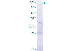 Image no. 1 for Vacuolar Protein Sorting 39 Homolog (VPS39) (AA 1-875) protein (GST tag) (ABIN1325084)