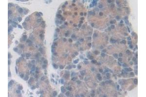 Detection of PDXK in Rat Pancreas Tissue using Polyclonal Antibody to Pyridoxal Kinase (PDXK)