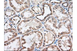 Immunohistochemical staining of paraffin-embedded Human liver tissue using anti-EIF2S1 mouse monoclonal antibody. (EIF2S1 anticorps)