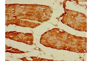 Immunohistochemistry of paraffin-embedded human skeletal muscle tissue using ABIN7153992 at dilution of 1:100 (GRIN2C anticorps  (AA 908-1007))