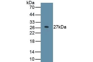 Detection of Recombinant WIF1, Human using Polyclonal Antibody to WNT Inhibitory Factor 1 (WIF1) (WIF1 anticorps  (AA 29-379))