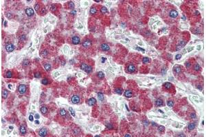 Human Liver: Formalin-Fixed, Paraffin-Embedded (FFPE) (PAR1 anticorps  (AA 24-37))