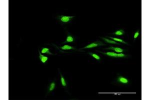 Immunofluorescence of purified MaxPab antibody to H2AFY2 on HeLa cell.