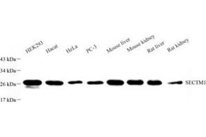 Western blot analysis of SECTM1 (ABIN7075524) at dilution of 1: 1000 (SECTM1 anticorps)