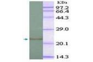 Image no. 2 for anti-Interleukin 1, beta (IL1B) (AA 118-269) antibody (ABIN791567) (IL-1 beta anticorps  (AA 118-269))