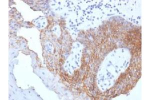 IHC testing of FFPE human tongue carcinoma with CD44v9 antibody (clone CD44v9/1459). (CD44v9 anticorps)