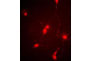 Immunofluorescence image of cultured chick retinal amacrine (neuronal) cells labeled with CLC4 Antibody (C-term). (CLCN4 anticorps  (C-Term))