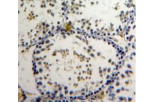 Used in DAB staining on fromalin fixed paraffin-embedded Testis tissue (ZNF384 anticorps  (AA 307-540))