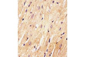 (ABIN6242465 and ABIN6577972) staining (Mouse) Med15 in Mouse heart tissue sections by Immunohistochemistry (IHC-P - paraformaldehyde-fixed, paraffin-embedded sections). (MED15 anticorps  (C-Term))