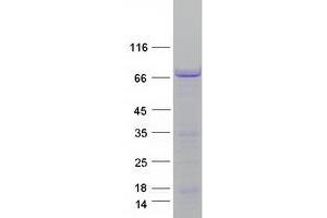 Validation with Western Blot