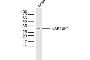 Mouse brain lysates probed with IRAK1BP1 Polyclonal Antibody, Unconjugated  at 1:300 dilution and 4˚C overnight incubation. (IRAK1BP1 anticorps  (AA 51-150))