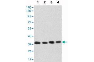 Western blot analysis using CDK5 monoclonal antibody, clone 4E4  against HeLa (1), K-562 (2), PC-12 (3) and COS-7 (4) cell lysate. (CDK5 anticorps)