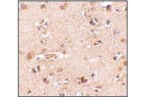 Immunohistochemistry of Nanos2 in human brain tissue cells with this product at 2. (NANOS2 anticorps  (N-Term))