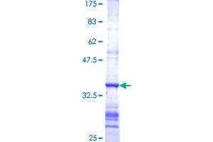 Image no. 1 for Ferredoxin Reductase (FDXR) (AA 394-491) protein (GST tag) (ABIN1353941)