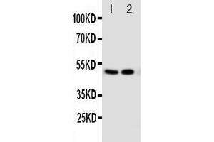 Anti-VDR antibody, Western blotting Lane 1: MCF-7 Cell Lysate Lane 2: HELA Cell Lysate
