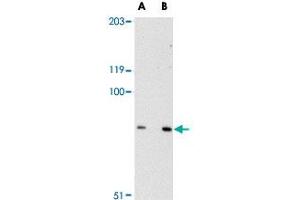 Western blot analysis of SPG11 in mouse heart tissue lysate with SPG11 polyclonal antibody  at (A) 0. (SPG11 anticorps  (C-Term))