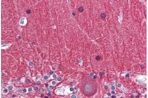 Human Brain, Cerebellum: Formalin-Fixed, Paraffin-Embedded (FFPE)