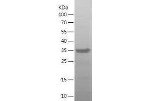 Western Blotting (WB) image for Sialophorin (SPN) (AA 27-253) protein (His tag) (ABIN7125088)