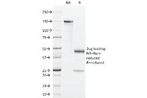 SDS-PAGE Analysis Purified GM-CSF Rat Monoclonal Antibody (BVD2-21C11).