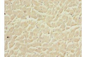 Immunohistochemistry of paraffin-embedded human heart tissue using ABIN7148495 at dilution of 1:100