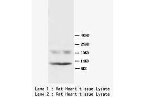 Image no. 1 for anti-Phospholamban (PLN) (N-Term) antibody (ABIN1495356) (Phospholamban anticorps  (N-Term))