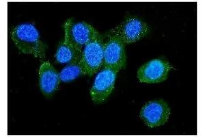 IF analysis of LCP1 using anti-LCP1 antibody (ABIN6719421). (LCP1 anticorps)