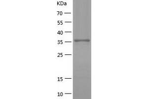 Western Blotting (WB) image for Zinc Finger Protein interacting with Ribonucleoprotein K (ZIK1) (AA 1-384) protein (His-IF2DI Tag) (ABIN7125804)