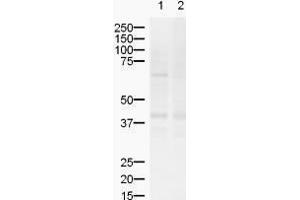 Western blot using  Affinity Purified anti-ZIC2 antibody shows detection of a band ~55 kDa (arrowhead) corresponding to ZIC2 in lysates from (lane 1) mouse brain and (lane 2) rat brain. (ZIC2 anticorps  (AA 189-206))