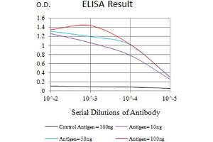 Black line: Control Antigen (100 ng),Purple line: Antigen (10 ng), Blue line: Antigen (50 ng), Red line:Antigen (100 ng)