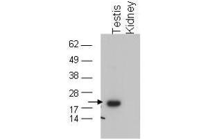 Image no. 1 for anti-Glutathione Peroxidase 4 (GPX4) (C-Term) antibody (ABIN199918) (GPX4 anticorps  (C-Term))
