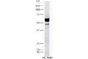 Mouse heart lysates probed with Anti-TXA2R Polyclonal Antibody, Unconjugated  at 1:300 in 4˚C.