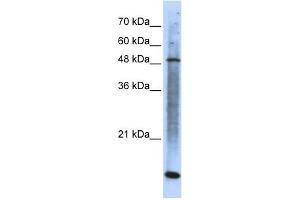 WB Suggested Anti-SMARCE1 Antibody Titration: 0. (SMARCE1 anticorps  (N-Term))