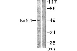 Western Blotting (WB) image for anti-Potassium Inwardly-Rectifying Channel, Subfamily J, Member 16 (KCNJ16) (Ser416) antibody (ABIN1848056) (KIR5.1 anticorps  (Ser416))