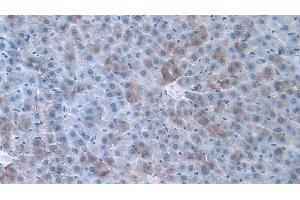 Detection of a1AGP in Rat Liver Tissue using Monoclonal Antibody to Alpha-1-Acid Glycoprotein (a1AGP)